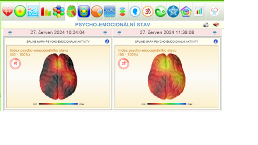 Psycho-emocionální stav